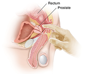 Side view of male pelvic organs showing digital rectal exam.